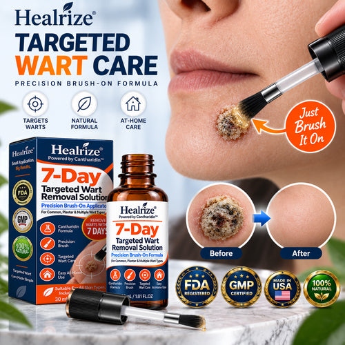 🏆🏆 𝐇𝐞𝐚𝐥𝐫𝐢𝐳𝐞® 𝐂𝐚𝐧𝐭𝐡𝐚𝐫𝐢𝐝𝐢𝐧™ 𝟕-𝐃𝐚𝐲 𝐀𝐝𝐯𝐚𝐧𝐜𝐞𝐝 𝐏𝐫𝐞𝐜𝐢𝐬𝐢𝐨𝐧 𝐁𝐫𝐮𝐬𝐡-𝐎𝐧 𝐖𝐚𝐫𝐭 𝐑𝐞𝐦𝐨𝐯𝐚𝐥 𝐒𝐨𝐥𝐮𝐭𝐢𝐨𝐧 ✅ (𝐓𝐚𝐫𝐠𝐞𝐭𝐞𝐝 𝐀𝐩𝐩𝐥𝐢𝐜𝐚𝐭𝐢𝐨𝐧, 𝐑𝐞𝐦𝐨𝐯𝐞 𝐀𝐥𝐥 𝐓𝐲𝐩𝐞𝐬 𝐨𝐟 𝐖𝐚𝐫𝐭𝐬 𝐖𝐢𝐭𝐡𝐢𝐧 𝟕 𝐃𝐚𝐲𝐬)