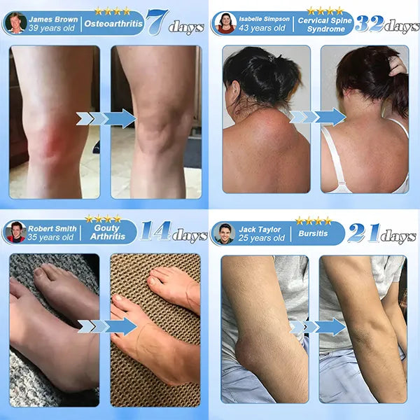 𝐉𝐎𝑨𝑬® 𝑵𝒂𝐧𝐨 𝐏𝐞𝐧𝐞𝒕𝒓𝒂𝒕𝒆 𝑨𝒅𝒗𝒂𝗻𝗰𝗲𝗱 𝗣𝐚𝐢𝐧 𝐑𝐞𝒍𝒊𝒆𝒇 𝑮𝐞𝐥 💕🔥 | 𝐅𝐚𝐬𝐭 𝐂𝐨𝐦𝒇𝒐𝒓𝒕 & 𝑳𝒐𝒏𝒈-𝑻𝒆𝒓𝒎 𝑱𝒐𝒊𝒏𝒕 & 𝑴𝒖𝒔𝒄𝒍𝒆 𝑪𝒂𝒓𝒆 | 𝑳𝒊𝒅𝒐𝒄𝒂𝒊𝒏𝒆 + 𝑴𝒆𝒏𝒕𝒉𝒐𝒍 + 𝑴𝑺𝑴 + 𝑻𝒚𝒑𝒆 𝑰𝑰 𝑪𝒐𝒍𝒍𝒂𝒈𝒆𝒏 𝑭𝒐𝒓𝒎𝒖𝒍𝒂 | 𝑭𝒐𝒓 𝑱𝒐𝒊𝒏𝒕 𝑷𝒂𝒊𝒏, 𝑴𝒖𝒔𝒄𝒍𝒆 𝑺𝒐𝒓𝒆𝒏𝒆𝒔𝒔 & 𝑺𝒕𝒊𝒇𝒇𝒏𝒆𝒔𝒔 💥