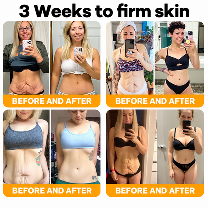 Made and Shipped from USA  🎉🎉🎉𝑺𝒂𝙗𝙖𝙭® Bee Venom Comprehensive Cream  LAST DAY 80% OFF(Sagging Skin, Fine Lines, Loss of Firmness, Flat Bust, Drooping Hips, and More)