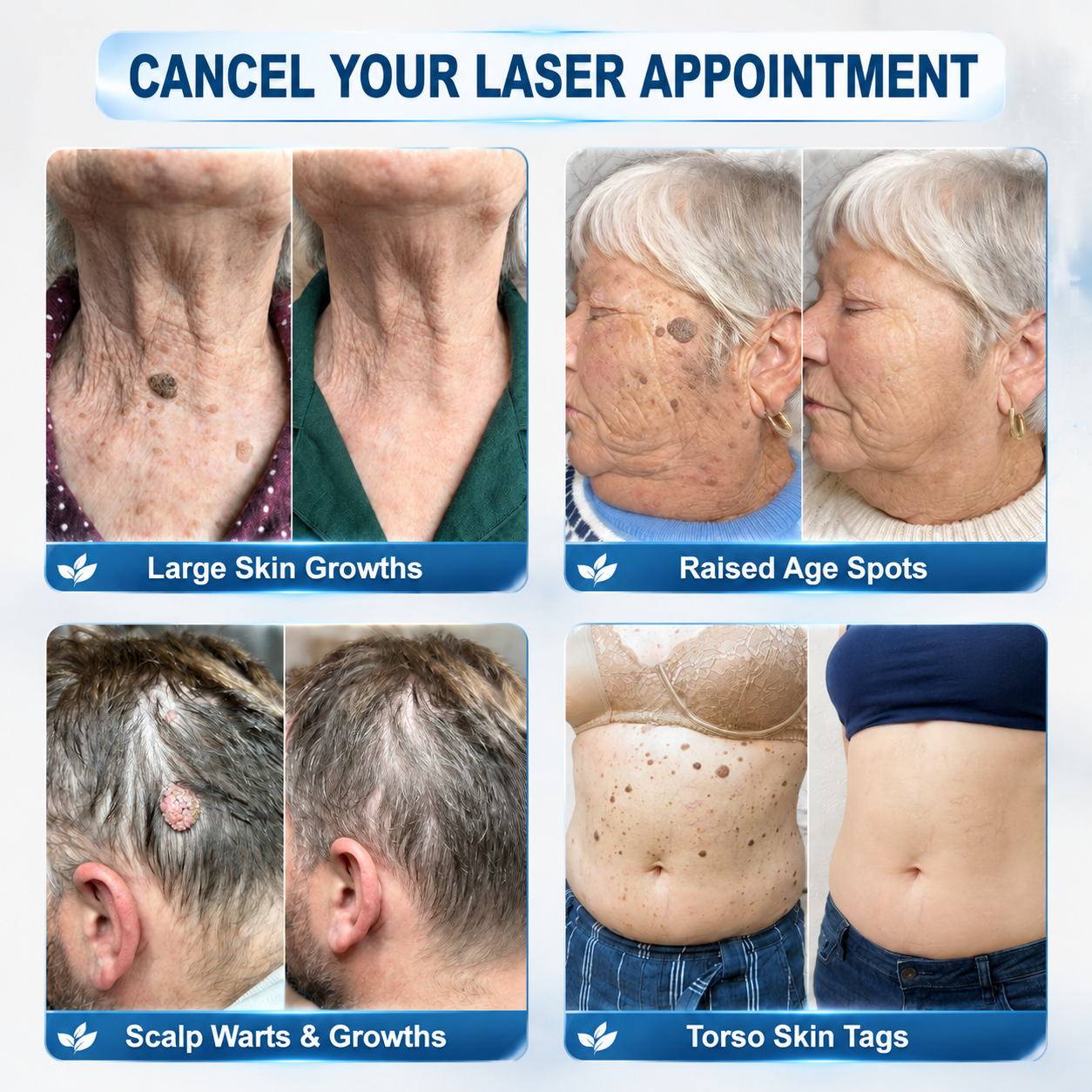 𝐏𝐡𝐚𝐫𝐦𝐚𝐜𝐢𝐬𝐭 𝐑𝐞𝐜𝐨𝐦𝐦𝐞𝐧𝐝𝐞𝐝 ✅ 𝐇𝐞𝐚𝒍𝒓𝒊𝒛𝗲® 𝟳-𝗗𝐚𝐲 𝐓𝐚𝐠 & 𝐒𝒑𝒐𝒕 𝑬𝒓𝒂𝒔𝒆𝒓 🪄 (𝒁𝒆𝒓𝒐𝗣𝗮𝗶𝗻, 𝗭𝗲𝗿𝗼 𝗦𝗰𝗮𝗿𝘀 𝗥𝗼𝗹𝗹𝗲𝗿𝗯𝗮𝗹𝗹) 👩‍⚕️
