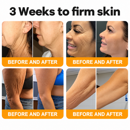 Made and Shipped from USA  🎉🎉🎉𝑺𝒂𝙗𝙖𝙭® Bee Venom Comprehensive Cream  LAST DAY 80% OFF(Sagging Skin, Fine Lines, Loss of Firmness, Flat Bust, Drooping Hips, and More)