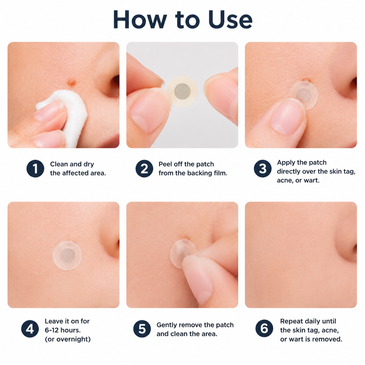 𝑯𝒆𝒂𝒍𝒓𝒊𝒛𝒆® 👩‍⚕️👩‍⚕️ 2-𝒊𝒏-1 𝑴𝒊𝒄𝒓𝒐𝒏𝒆𝒆𝒅𝒍𝒆 & 𝑯𝒚𝒅𝒓𝒐𝒄𝒐𝒍𝒍𝒐𝒊𝒅 𝑷𝒂𝒕𝒄𝒉 | 𝑹𝒆𝒎𝒐𝒗𝒆𝒔 𝑹𝒂𝒊𝒔𝒆𝒅 𝑴𝒐𝒍𝒆𝒔, 𝑨𝒄𝒏𝒆, 𝑭𝒍𝒂𝒕 𝑾𝒂𝒓𝒕𝒔 & 𝑺𝒌𝒊𝒏 𝑻𝒂𝒈𝒔 | 𝑯𝒆𝒍𝒑𝒔 𝑰𝒎𝒑𝒓𝒐𝒗𝒆 𝑾𝒓𝒊𝒏𝒌𝒍𝒆𝒔, 𝑺𝒄𝒂𝒓𝒔 & 𝑩𝒍𝒆𝒎𝒊𝒔𝒉𝒆𝒔 | 𝑰𝒏𝒗𝒊𝒔𝒊𝒃𝒍𝒆 𝑷𝒂𝒕𝒄𝒉𝒆𝒔 𝒇𝒐𝒓 𝑭𝒂𝒄𝒆 & 𝑩𝒐𝒅𝒚